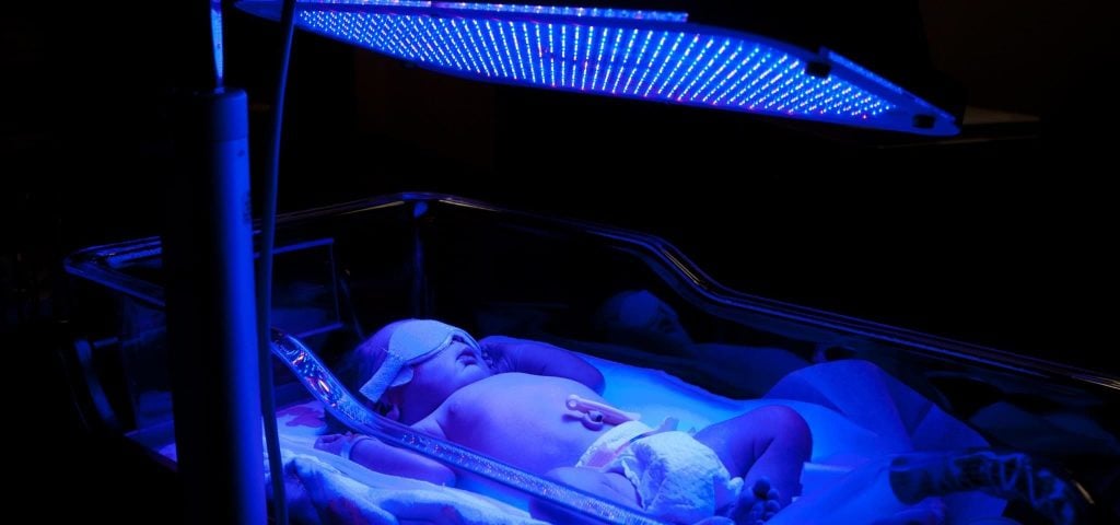 Fototerapia descubre cómo funciona y sus tratamientos WeMystic