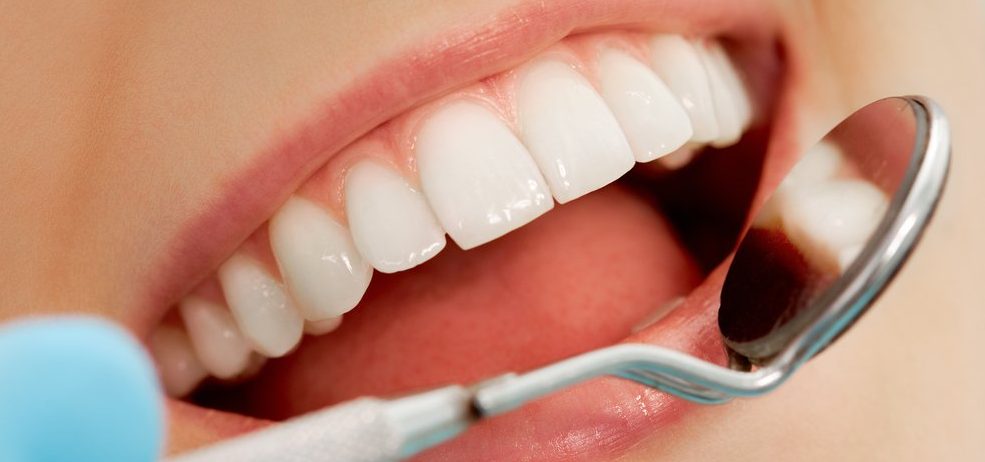 descodificación dental